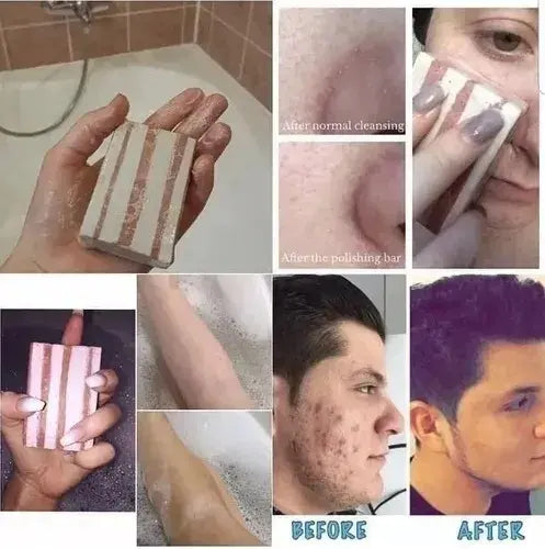 Epoch® Barra Exfoliante Purificante (Polishing Bar)